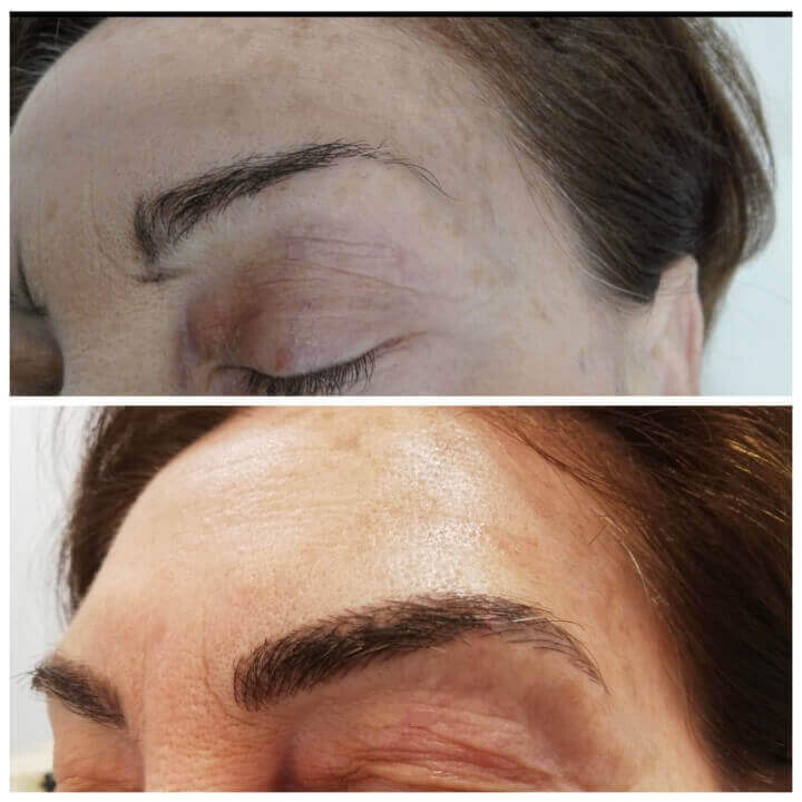 Microblading